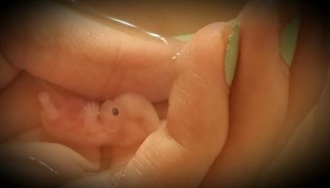 was 8 weeks, 5 days old when her mother had a miscarriage and took this photo of her. Planned Parenthood commonly commits abortions at this age.