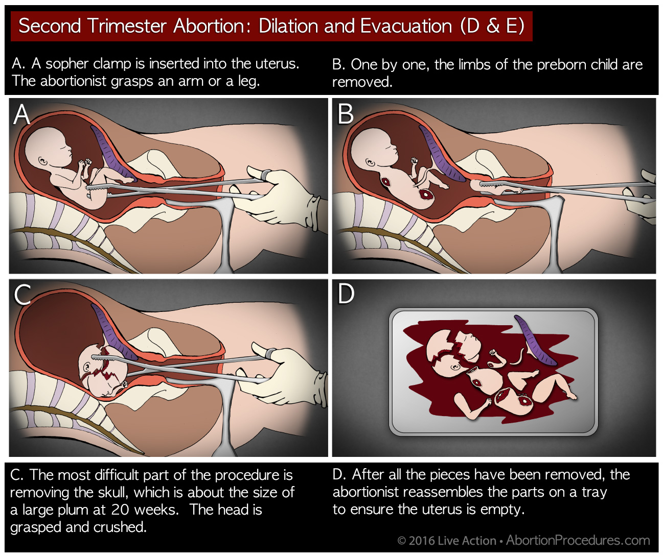 Requests for this procedure at Planned Parenthood were sent to the top of the queue.