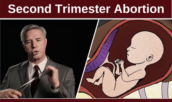 dismemberment abortion, YouTube, D&E