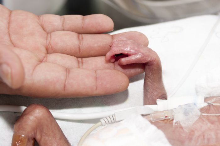 Heartbreaking: Infant survives abortion, mother holds him until he dies