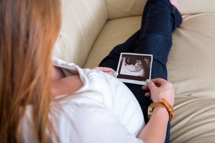 abortion sidewalk counseling, ultrasound