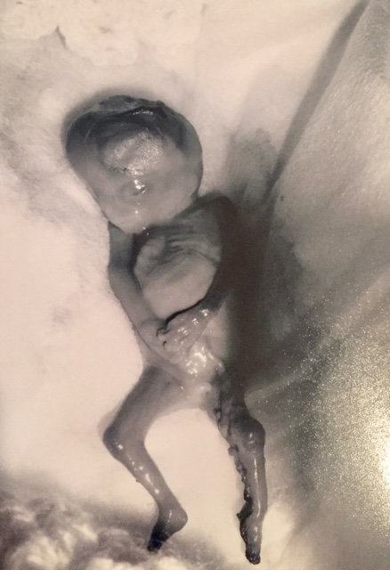 13 or 16 weeks, miscarriage, Michael John