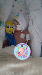 photo used with permission from UK octopus for preemies group