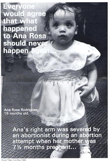 Ana Rosa Rodriguez one of many babies born alive after failed abortion attempt