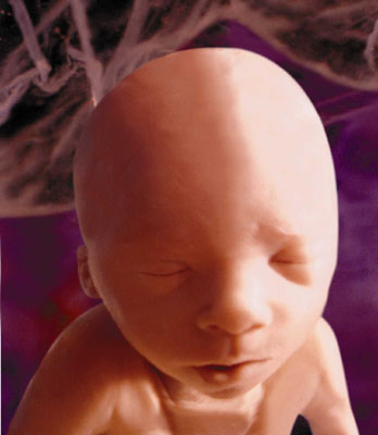 A human baby at 24 weeks, after the first trimester