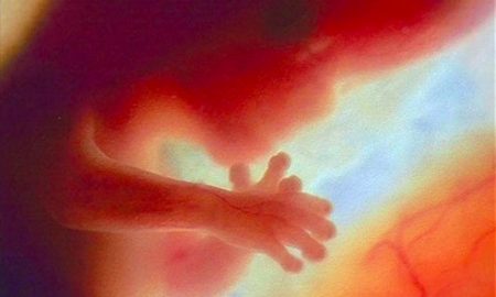 first trimester, pro-life, abortion, Nebraska
