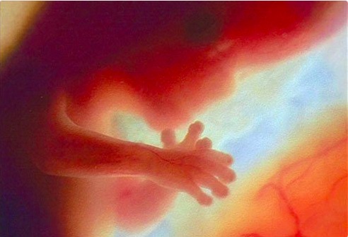 A human baby at 12 weeks, near the end of the first trimester