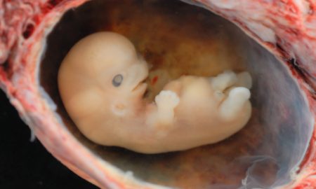 heartbeat abortion bill, pro-life