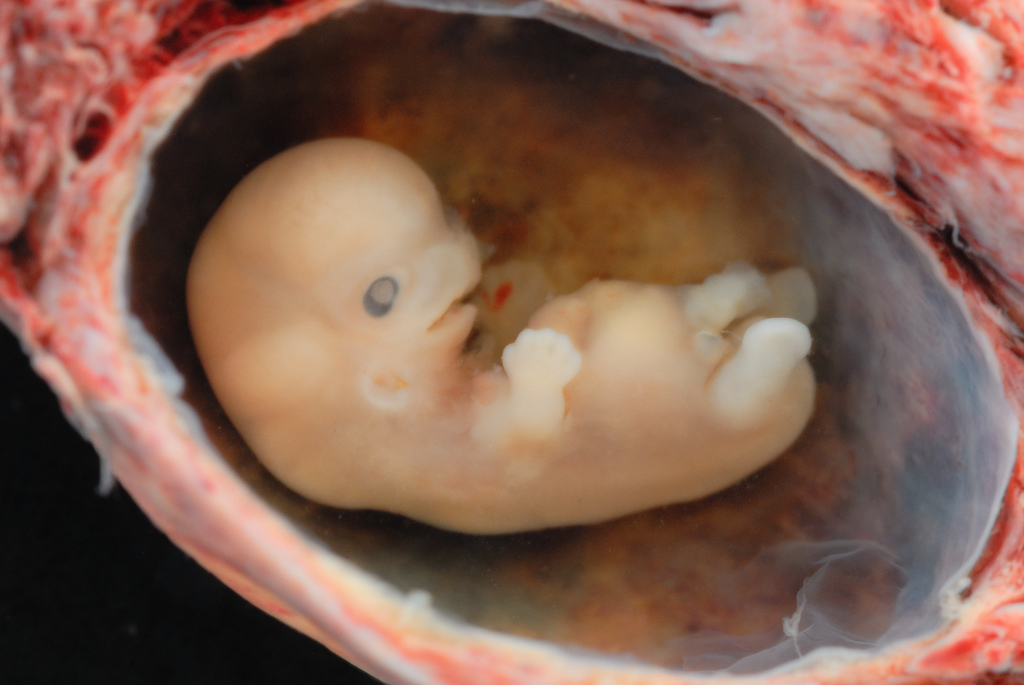 heartbeat abortion bill, pro-life