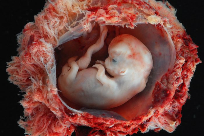 8 weeks gestation, in the first trimester. (Photo credit: Lunar Caustic)