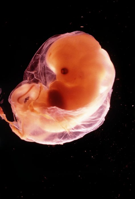 Amazing photos of preborn babies in the womb show that life begins at