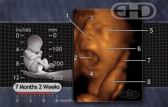 yawning 30 weeks 7 months fetus