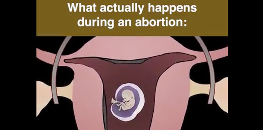 live-action-abortion-pill-video