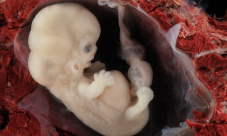 heart, embryo, heartbeat abortion bill, embryo, science