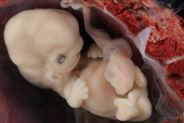 heartbeat, embryo, preborn