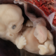 heartbeat, embryo, preborn