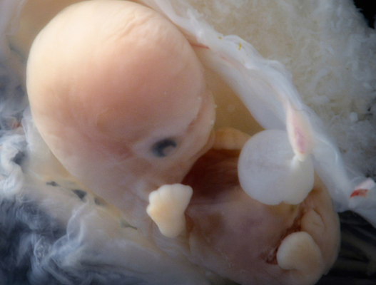 6-7 week gestational age from conception, 8-9 weeks LMP