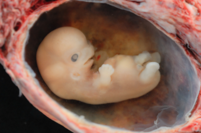 A human baby at 6 weeks, in the first trimester