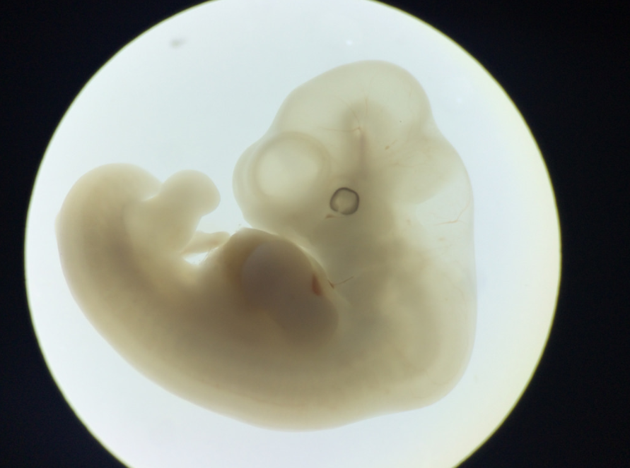 7 week embryo