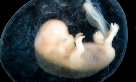 ectopic pregnancy, eight weeks, miscarriage, baby, fetus, embryo, fetal