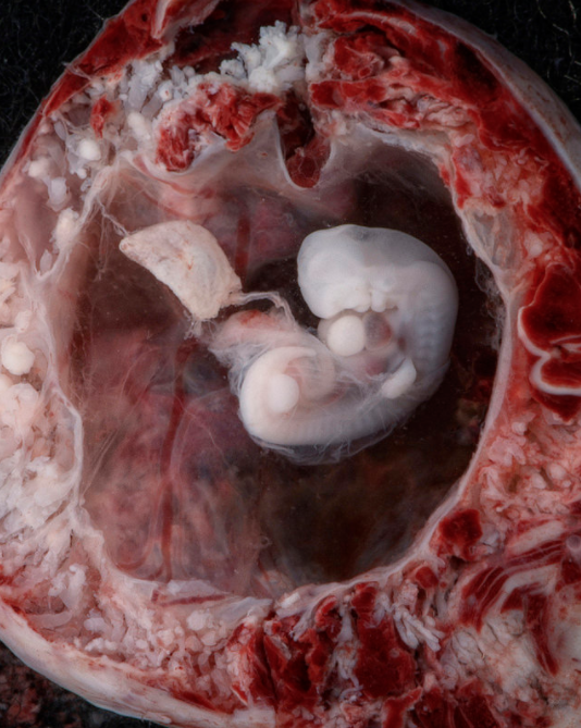 Human child at 4 to 5 weeks, in the first trimester. (Photo credit: Lunar Caustic)