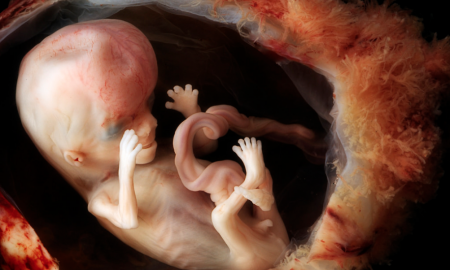fetal, abortion, abortionist
