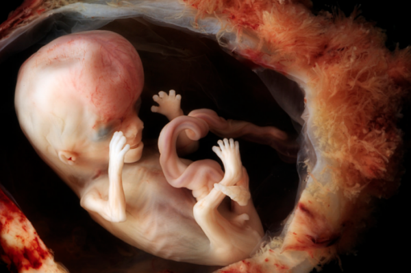 fetal, abortion, abortionist