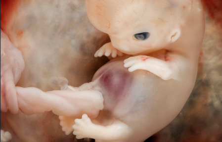 Stunning images of preborn children show that human life begins at fertilization