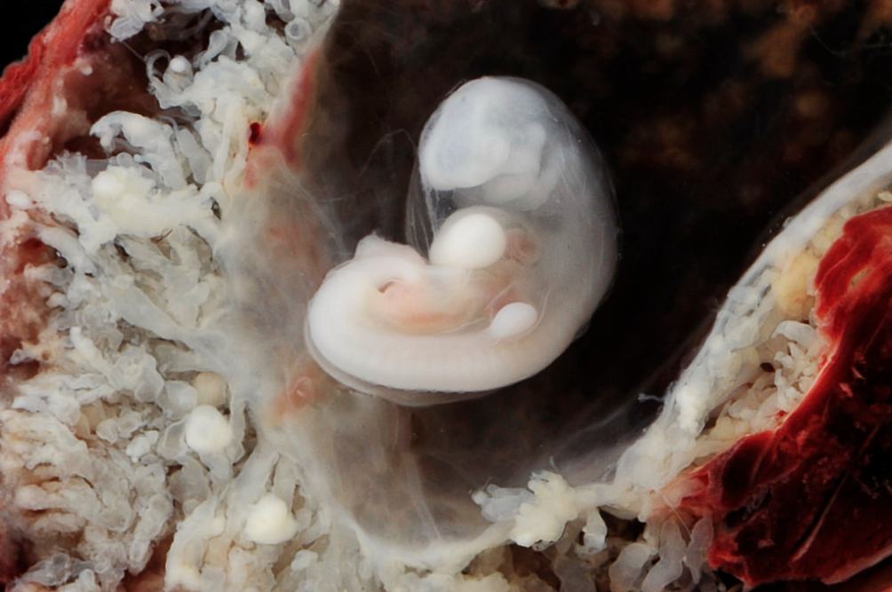 embryo 3 to 4 weeks