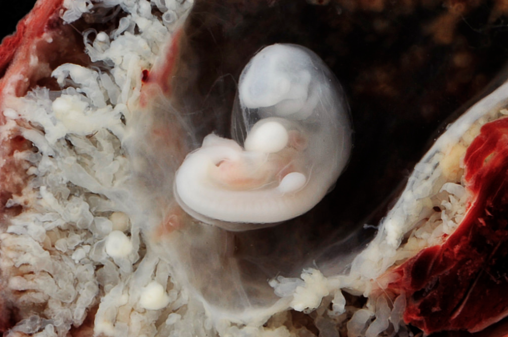 embryos