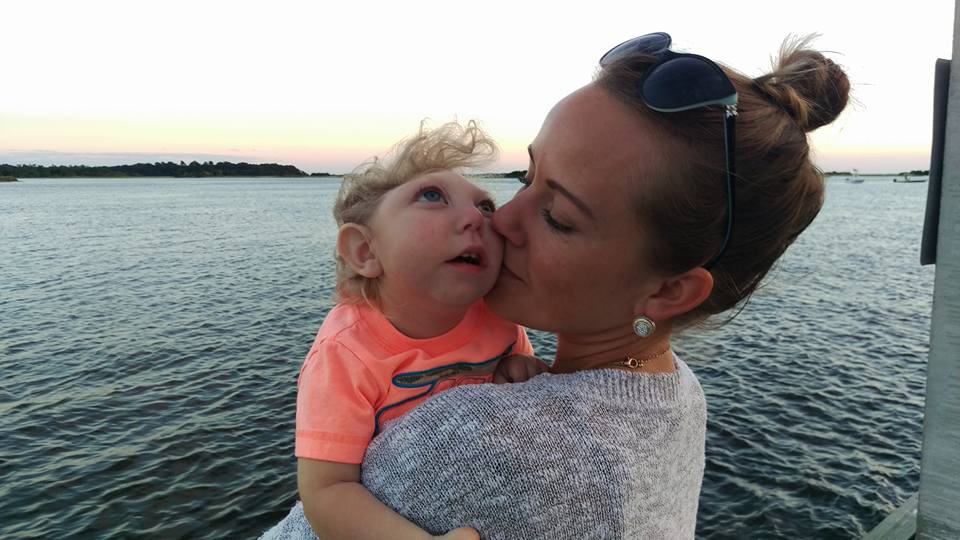 Missing 80 percent of his brain, Jaxon Buell is still amazing his doctors as he turns 3