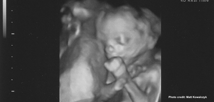 Baby Ella sucks her thumb at 19 weeks