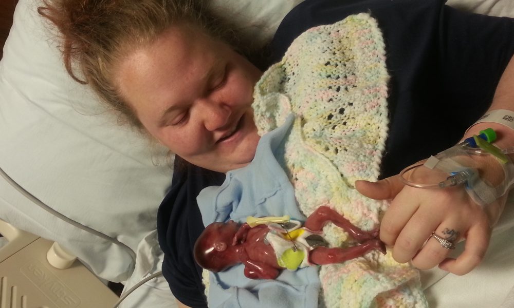 Mother shares powerful photos of baby miscarried at 20 ...