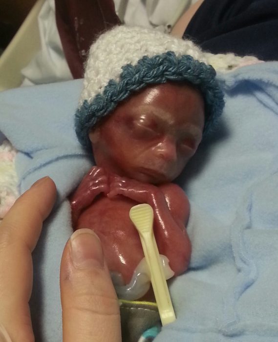 Mother shares powerful photos of baby miscarried at 20 ...