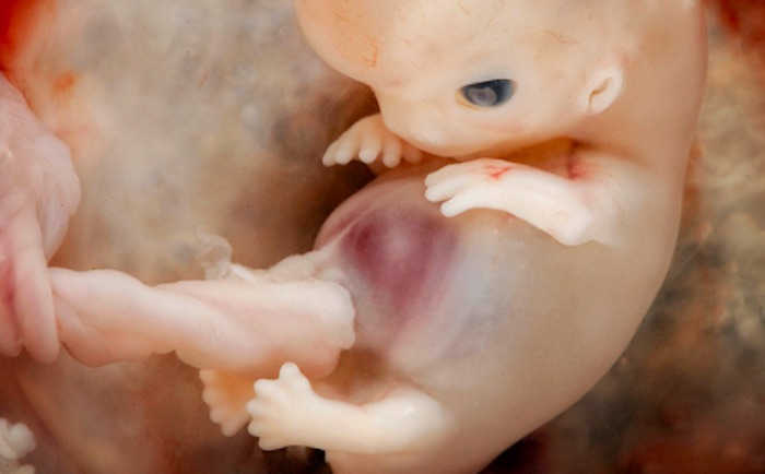 7-8 week embryo