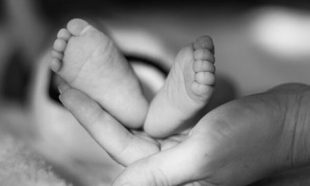 anencephaly, feet,