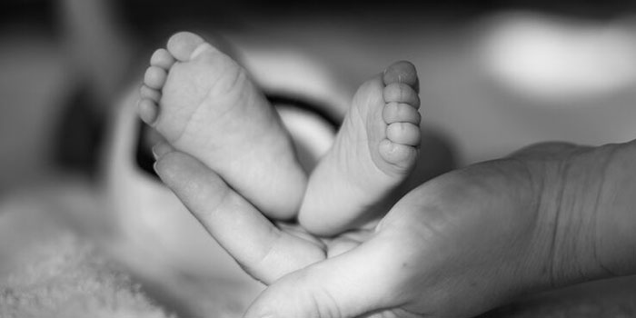 anencephaly, feet,