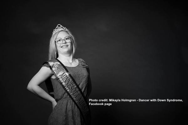 Mikayla Holmgren, who has Down syndrome, was a contestant in Miss Minnesota.