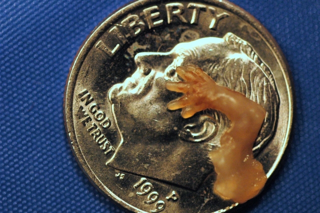 Hand and arm of aborted baby killed at Woman’s Choice abortion clinic. Whole arm fits on a dime. 7 weeks. Photo courtesy of prolifesociety.com and imagesofabortion.com.