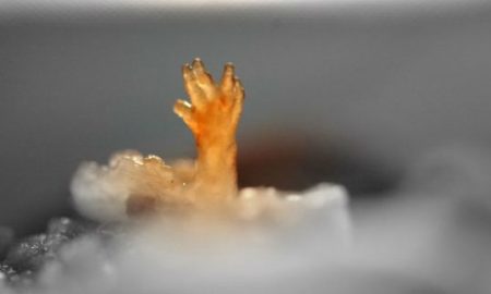 early abortion, A baby hand, pro-life, aborted