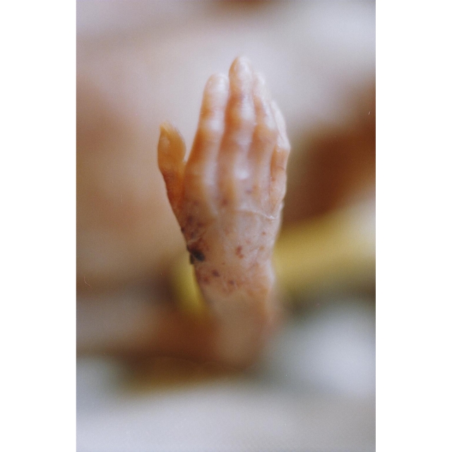 The delicate, human hand of a child who suffered an abortion. Note the tiny fingernails.