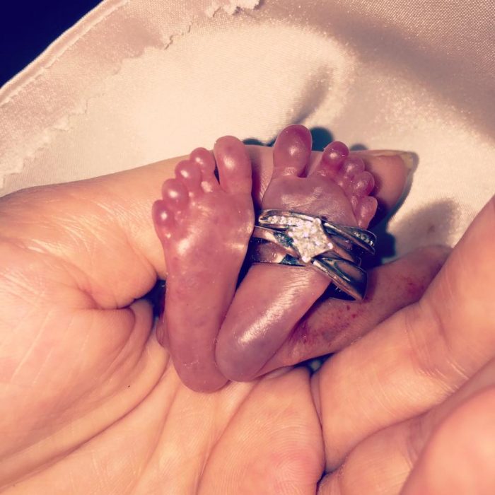 Premature baby girl Autumn's tiny feet with her parents' wedding bands.