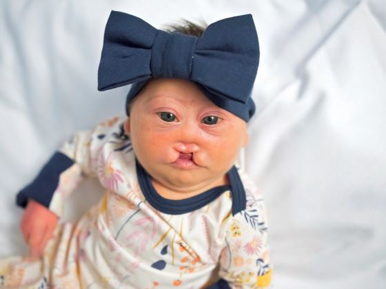 Blakely, whose parents refused abortion is now 7 months old. via YouCaring.com.