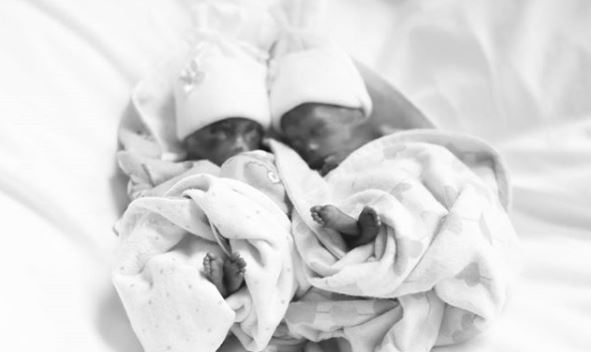 Mother shares powerful photos of identical twins ...