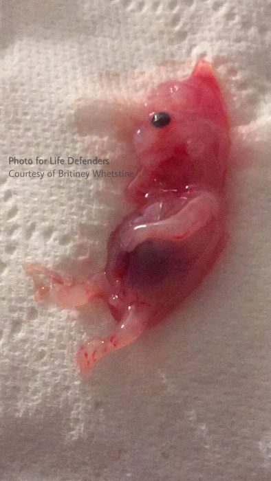 Britiney Whetstine had a miscarriage with her tiny son, pictured here.