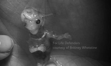 Miscarriage photo of her son from Britiney Whetstine