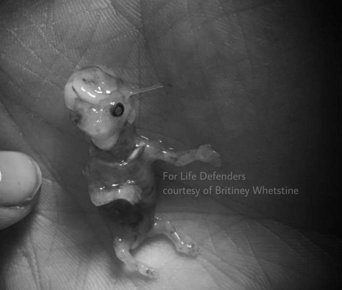 Miscarriage photo of her son from Britiney Whetstine