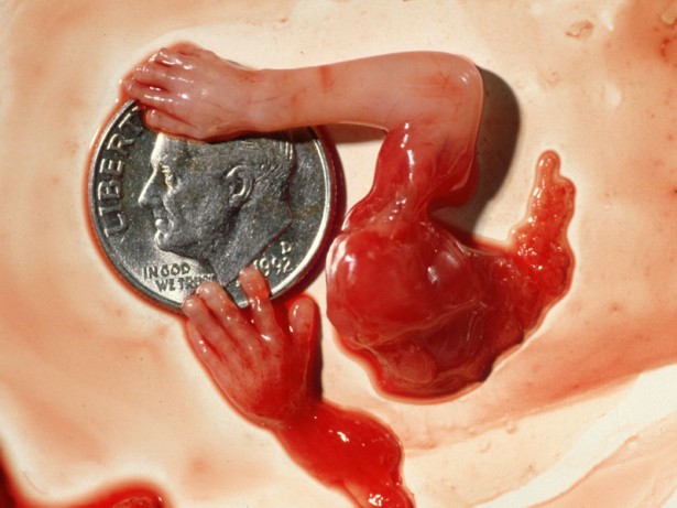 9 images that show the humanity of babies in the first trimester