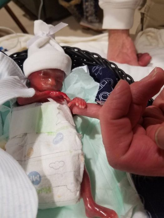 Family shares powerful photos of baby born at 19 weeks