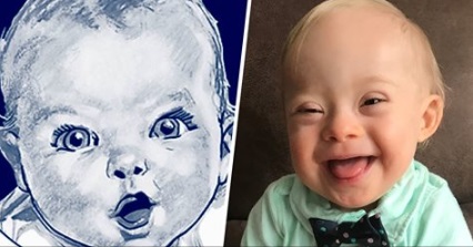 Image: Gerber selects first Baby with Down Syndrome in photo contest
